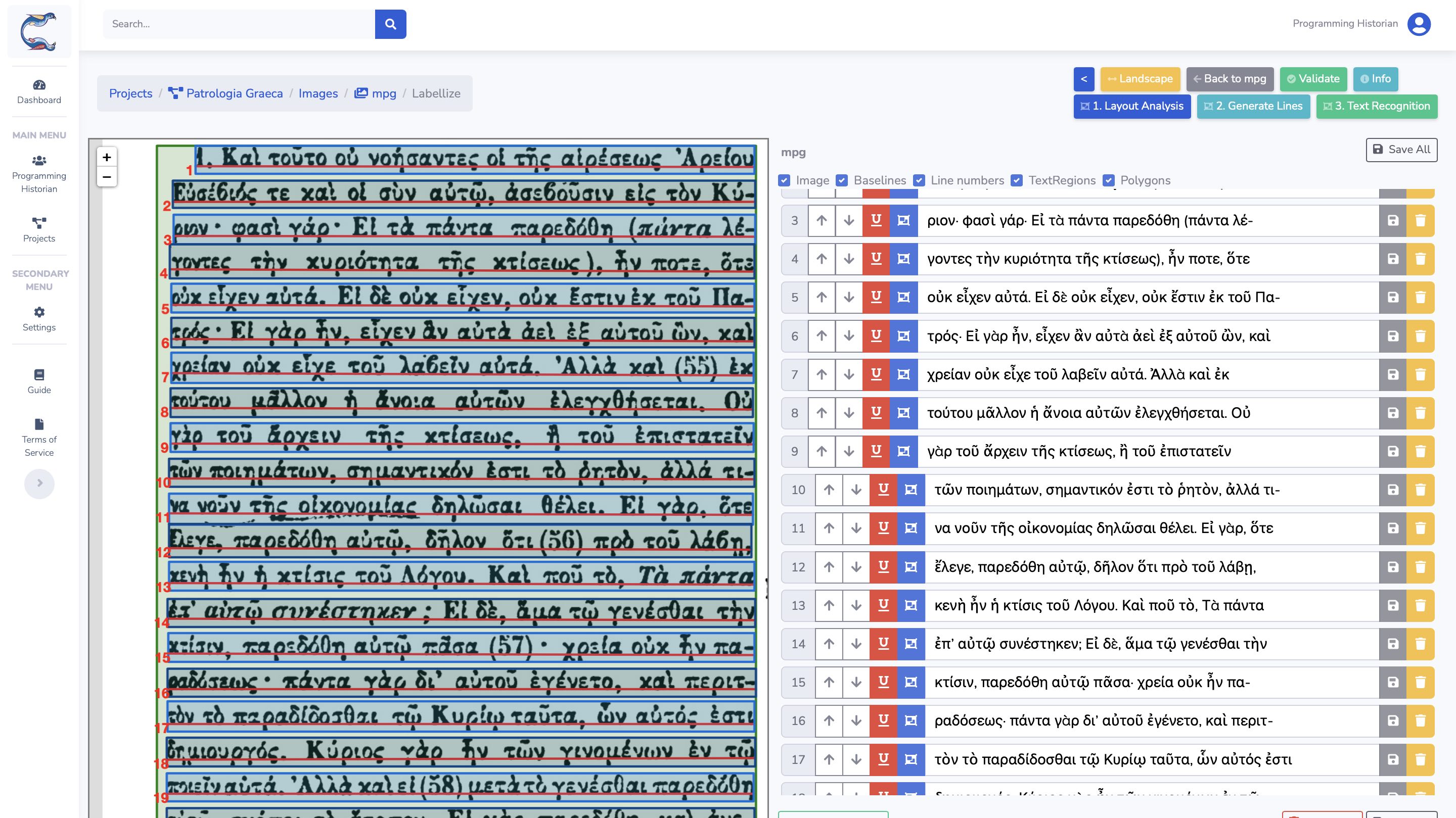 L'interface de transcription sur Calfa Vision